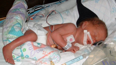 Д-р Борислава Чакърова: 16-дневно бебе е заразено с чревната инфекция гиардиаза!