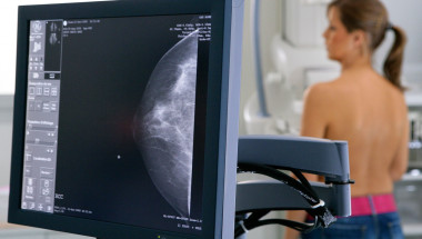 Тон Янсен: Противозачатъчните са главната причина за рака на гърдата!