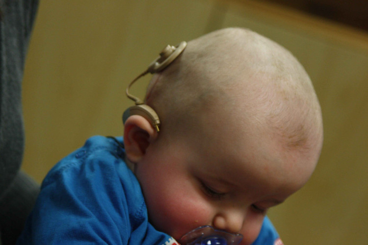 Във ВМА отново ще оперират  деца с тежко слухово увреждане