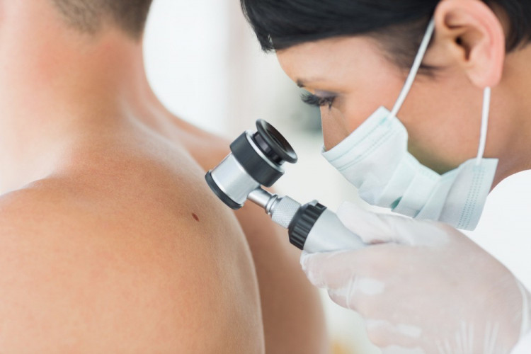 Д-р Даниел Янков: Хормоналните проблеми може да провокират рак на кожата!