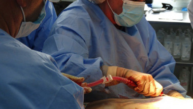 Три операции на гърда по иновативен метод извършиха в Първа АГ болница