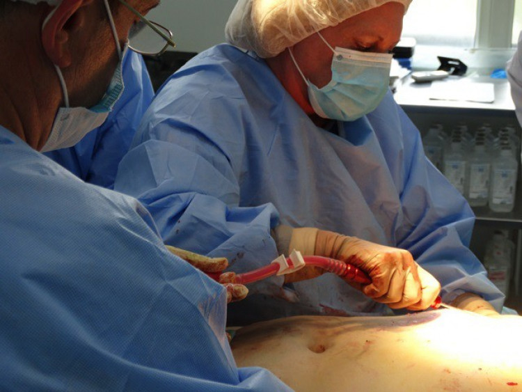 Три операции на гърда по иновативен метод извършиха в Първа АГ болница