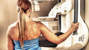 НЗОК покрива ли мамографията?