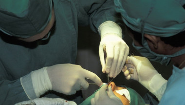 НЗОК плаща ли за ендоскопска операция на синусите?