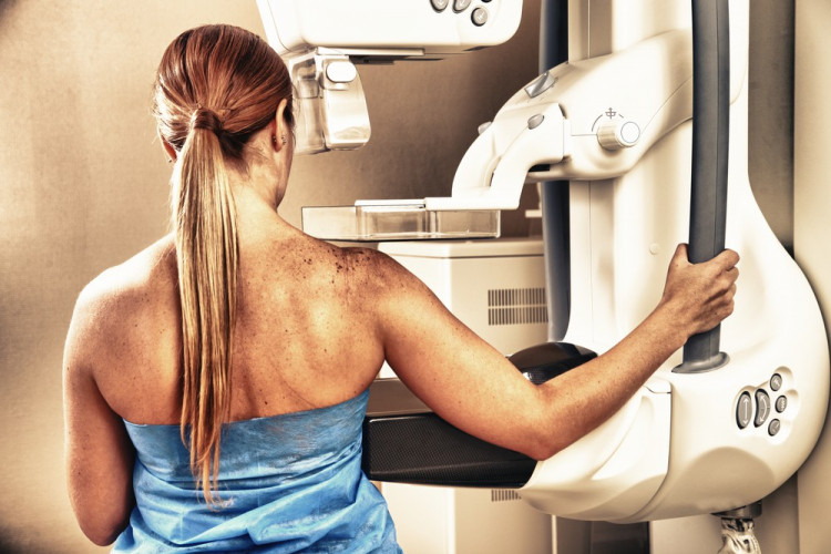 НЗОК покрива ли мамографията?