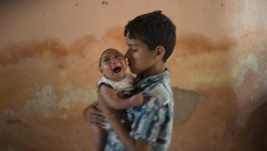 Страшният вирус Зика смалява главите на бебетата в Бразилия
