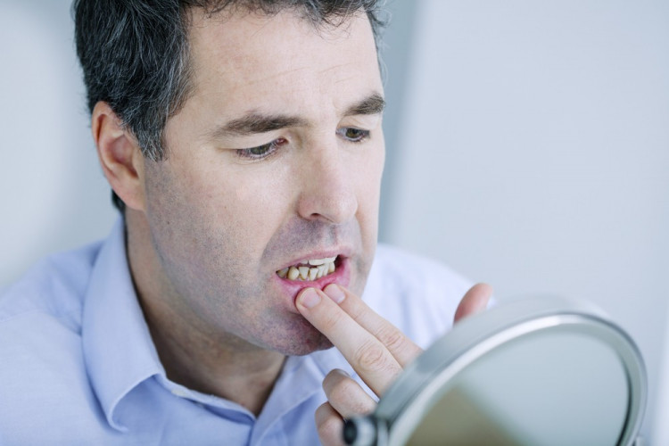 5 причини да се тревожите заради кръв от венците