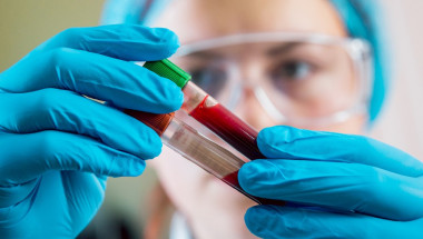 Имам ли право на безплатно изследване на кръвта при тиреотоксикоза?