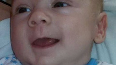 Зов за помощ: Тумор убива бебе на 3 месеца, събират пари за операция в Германия