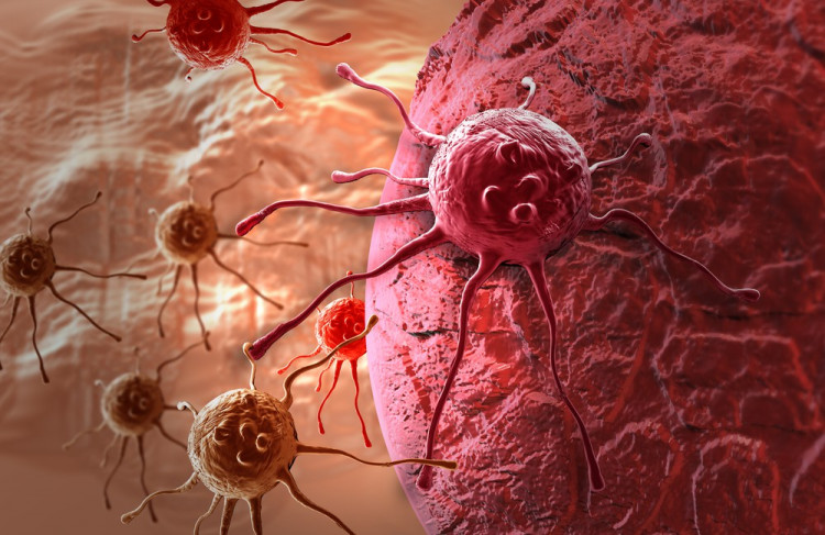 Гени или начин на живот - какви са причините за рака?