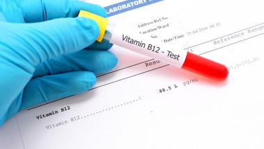 ​8 признака, че на тялото ви катастрофално липсва витамин B12