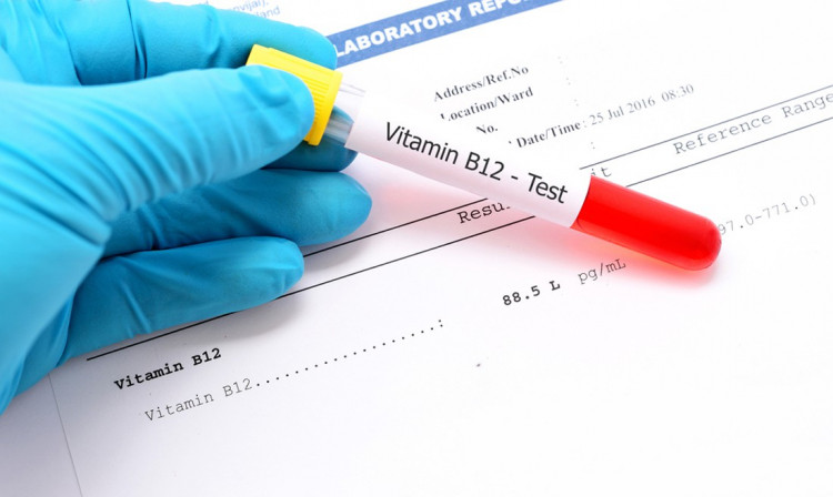 ​8 признака, че на тялото ви катастрофално липсва витамин B12