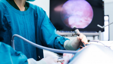 Плевенски онколози извършиха уникална безкръвна операция