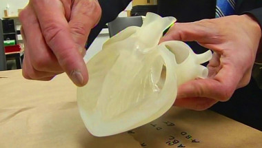 Проф. д-р Николай Габровски: 3D-принтиране на органи ще промени медицината