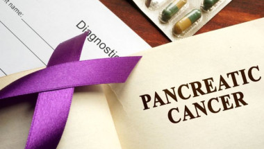 Водещи онколози разкриха как да разпознаем рака на панкреаса