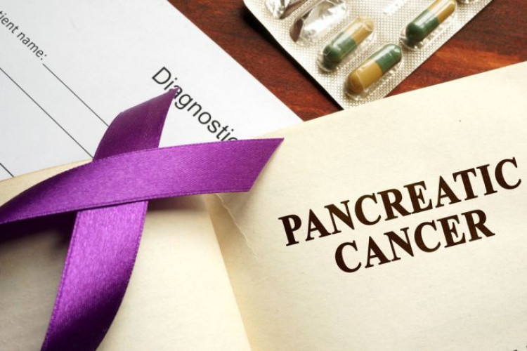 Водещи онколози разкриха как да разпознаем рака на панкреаса