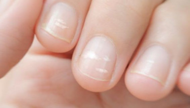 Ето как да разберете по ноктите имате ли здравословни проблеми и какви са те