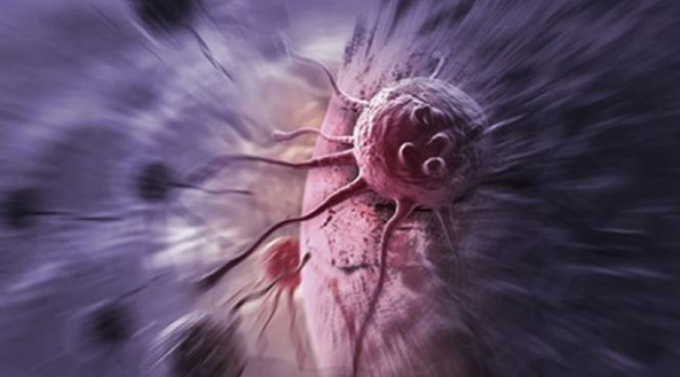 Учени публикуваха списък с най-главните фактори за рак