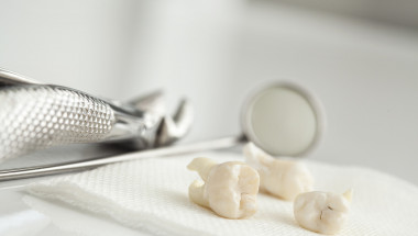 Зъболекарка разби брадати митове за зъбния камък