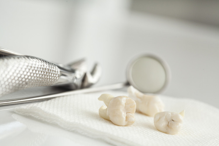 Зъболекарка разби брадати митове за зъбния камък