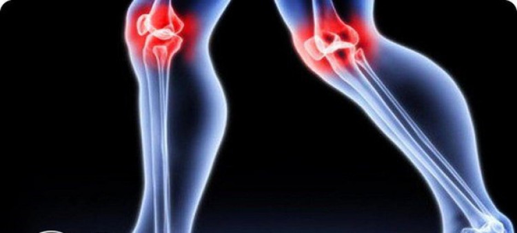 Най-добрите народни рецепти за болки в коленете