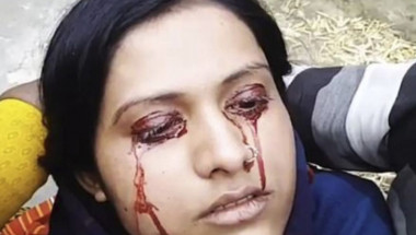 Изплашен индиец заряза младата си жена и я обяви за вещица, след като кървави сълзи започнаха да се стичат от очите й (СНИМКИ)