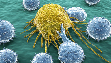 Д-р Александър Петровски: Содата и алкалната среда в тялото не могат да убият  раковите клетки