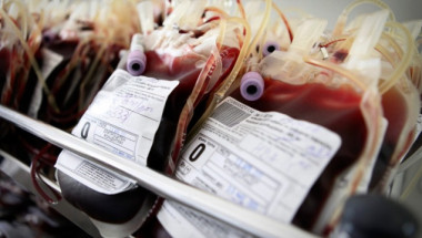 Учени доказаха подмладяващия ефект при преливането на кръв от младежи на възрастни хора