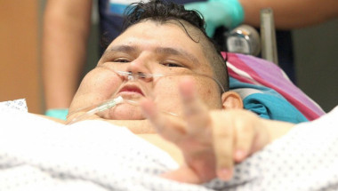 Не е за вярване какво се случи с най-тежкия човек в света: 590-килограмовия Хуан! (СНИМКИ)