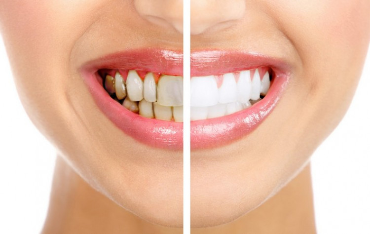 12 продукта правят истински чудеса със зъбите ви