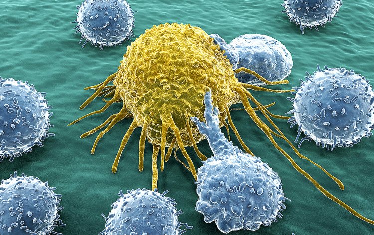 Д-р Александър Петровски: Содата и алкалната среда в тялото не могат да убият  раковите клетки