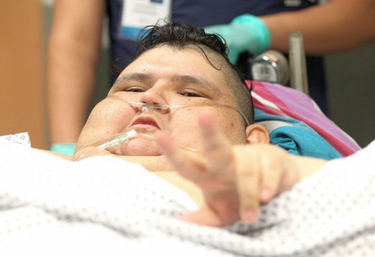 Не е за вярване какво се случи с най-тежкия човек в света: 590-килограмовия Хуан! (СНИМКИ)