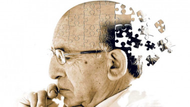 Учени разказаха как най-лесно се диагностицира Алцхаймер