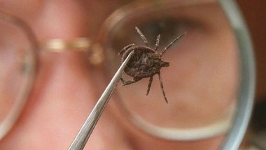 Лесен начин, който ще ви предпази да не бъдете жертва на кърлежи и насекоми (СНИМКИ)