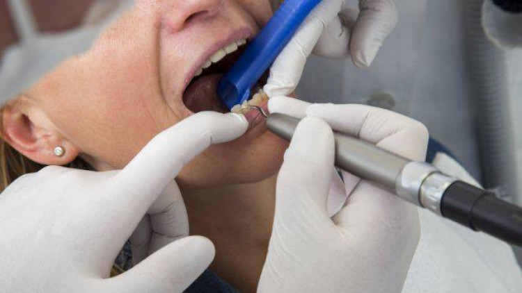 Лекарите разказаха как да спасите зъбите си от пожълтяването без скъпа козметика