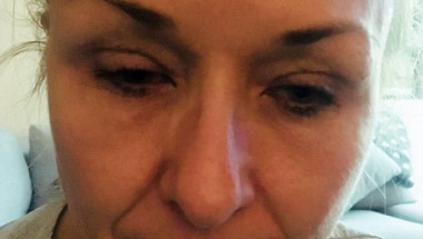Ужасяващи СНИМКИ 18+! Майка едва не загуби зрението си след като 25 години не беше сваляла грима си
