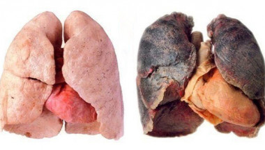Как да почистите белите дробове след пушене: 4 начина, по които ще премахнете токсините от тялото!