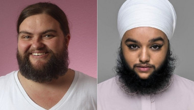 Жени с бради, на какво се дължи? (СНИМКИ)