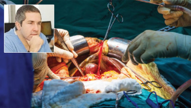 Доц. д-р Ивелин Такоров: Трансплантацията връща пациентите ни към нормален живот
