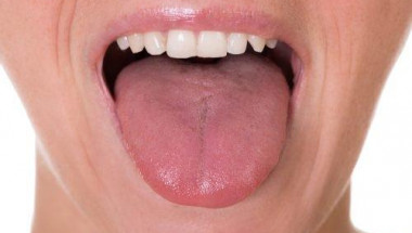 5 симптома на рак на езика