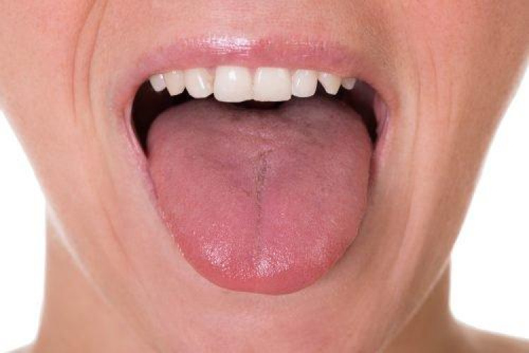 5 симптома на рак на езика