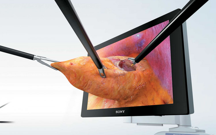 Иновативна 3D система за операции при рак  на простата и бъбрек