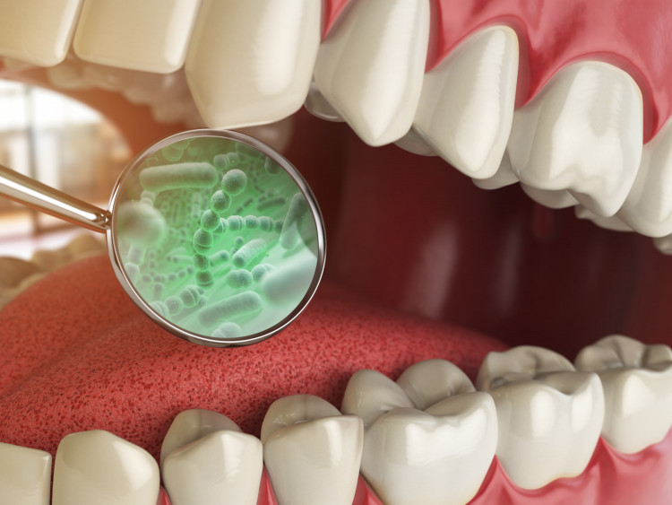 Бактерия  в устата ускорява растежа  на колоректалния рак