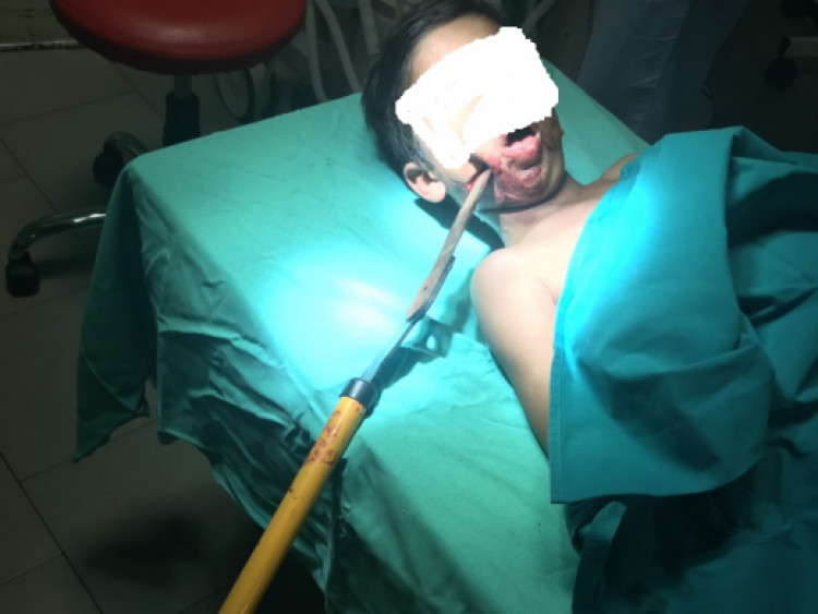Хирурзи от Бургас извършиха операция, която ще влезе в учебниците (СНИМКИ/ВИДЕО)