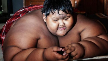 Как изглежда сега най-дебелото момче в света (СНИМКИ)