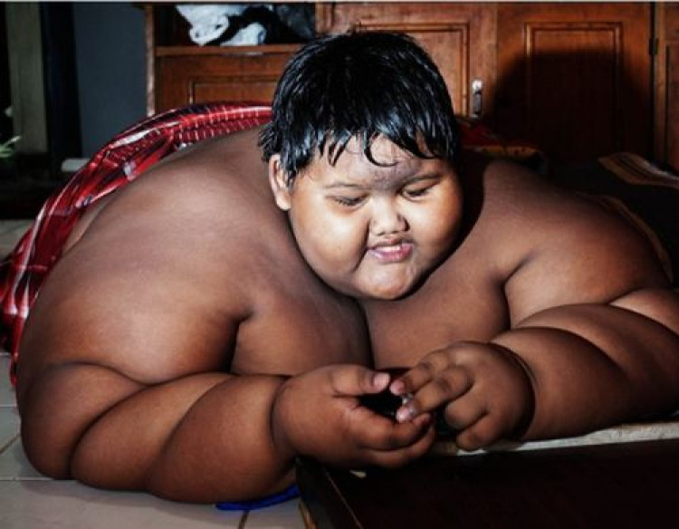 Как изглежда сега най-дебелото момче в света (СНИМКИ)
