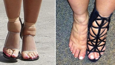 Подуването на краката може да бъде симптом за пет опасности