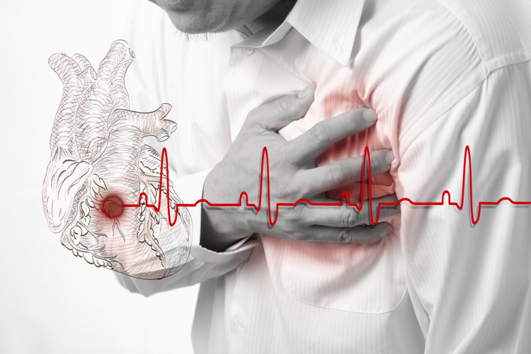 Микроинфарктът често протича без никакви симптоми