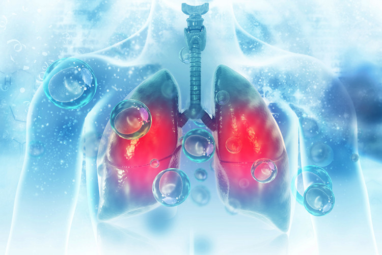 Д-р Николай Янев, д.м.: Нелекуваната ХОББ неминуемо води до дихателна недостатъчност