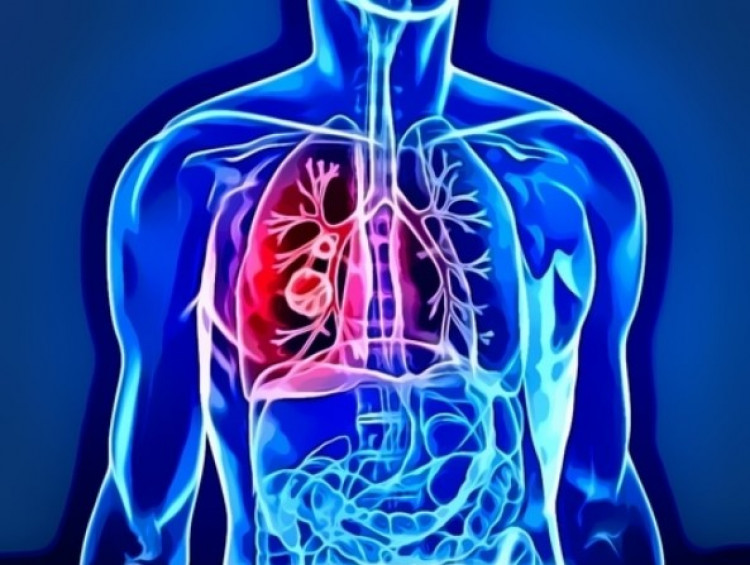 Колко живеят хората с диагноза рак на белия дроб?